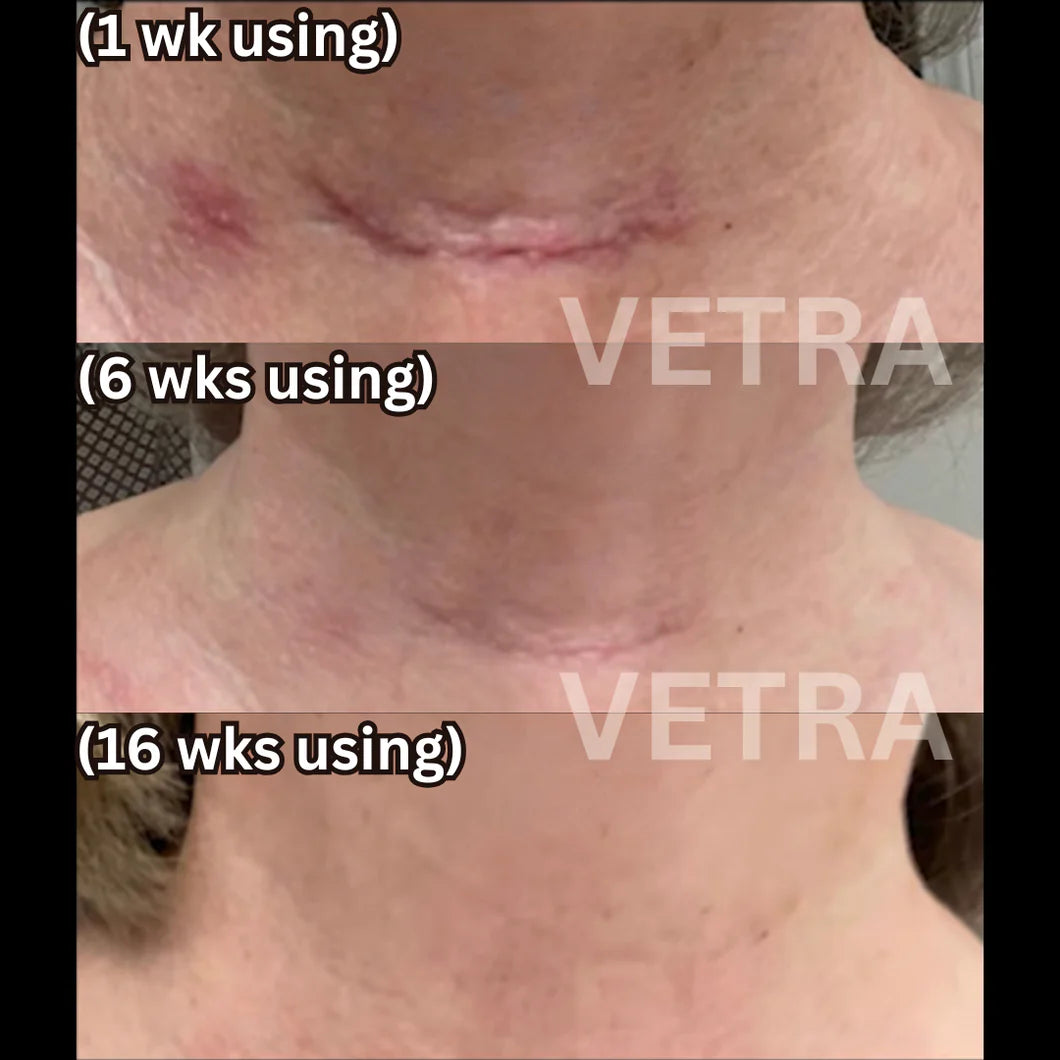 Clinical Scar Solutions Silicone Stick™