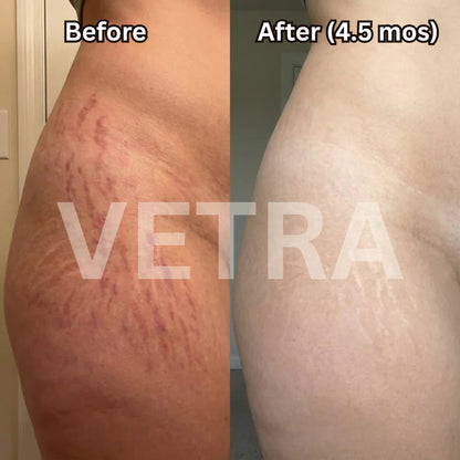 Clinical Scar Solutions Silicone Stick™
